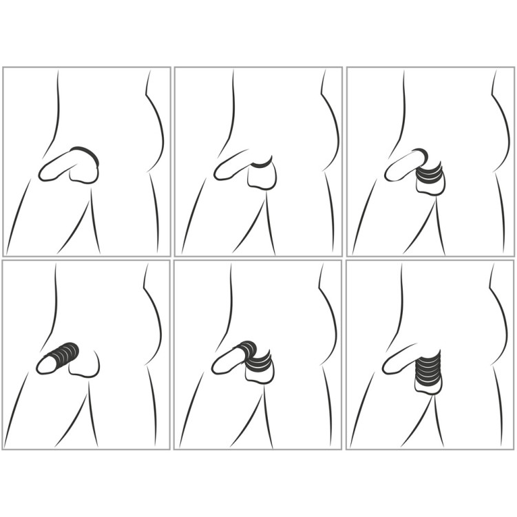 Cock & Ball Stretching Kit